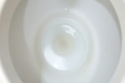 Μια αστραφτερή λεκάνη τουαλέτας που καθαρίζεται με ληγμένο γιαούρτι.