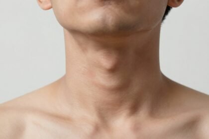 Φωτογραφία ενός λαιμού που δείχνει σημάδια θυρεοειδικών προβλημάτων.