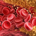 cholesterol - 12 τροφές που μειώνουν τη χοληστερόλη με φυσικό τρόπο σύμφωνα με διαιτολόγους
