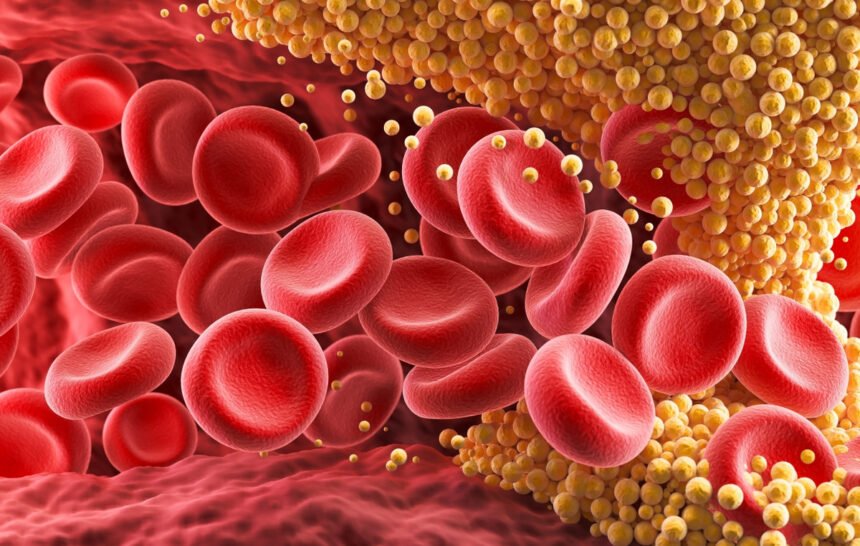 cholesterol - 12 τροφές που μειώνουν τη χοληστερόλη με φυσικό τρόπο σύμφωνα με διαιτολόγους