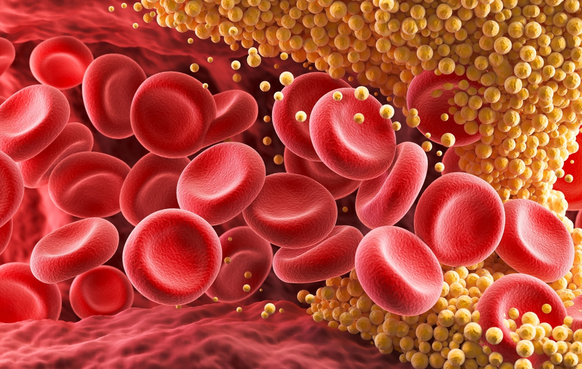 cholesterol - 12 τροφές που μειώνουν τη χοληστερόλη με φυσικό τρόπο σύμφωνα με διαιτολόγους