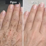 health translated feat - 3 λεπτά αρκούν: Το κόλπο της μαμάς για να καθαρίσουν τα χέρια σας από τις κηλίδες