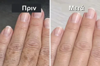 health translated feat - 3 λεπτά αρκούν: Το κόλπο της μαμάς για να καθαρίσουν τα χέρια σας από τις κηλίδες