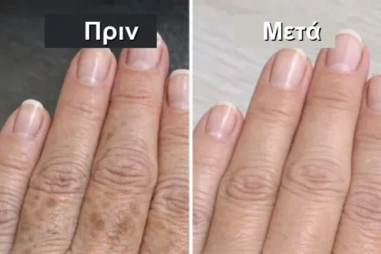 health translated feat - 3 λεπτά αρκούν: Το κόλπο της μαμάς για να καθαρίσουν τα χέρια σας από τις κηλίδες