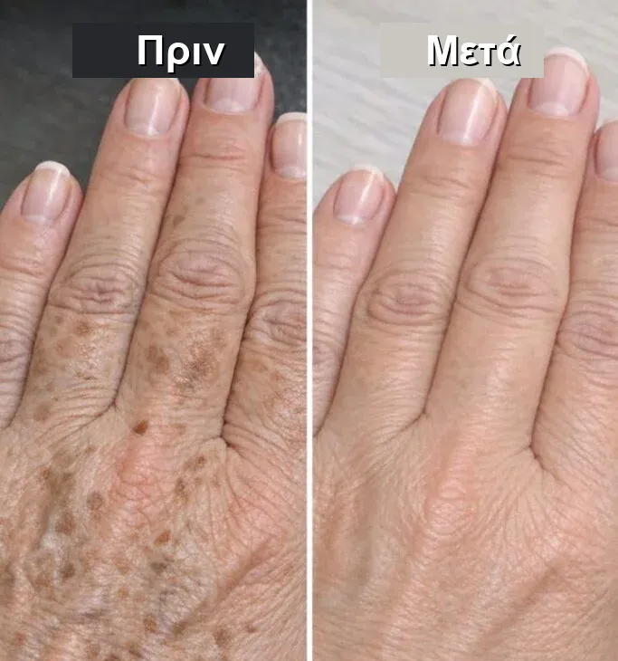 health translated feat - 3 λεπτά αρκούν: Το κόλπο της μαμάς για να καθαρίσουν τα χέρια σας από τις κηλίδες